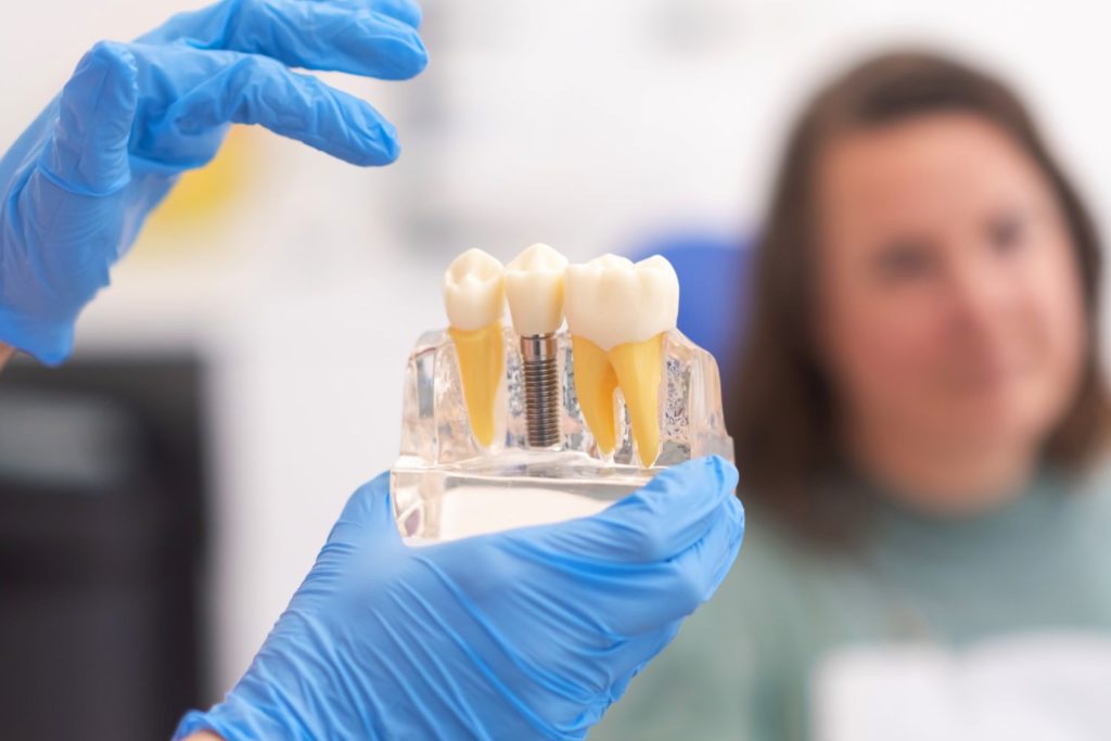 Most czy implant – porównanie rozwiązań przy brakach zębowych